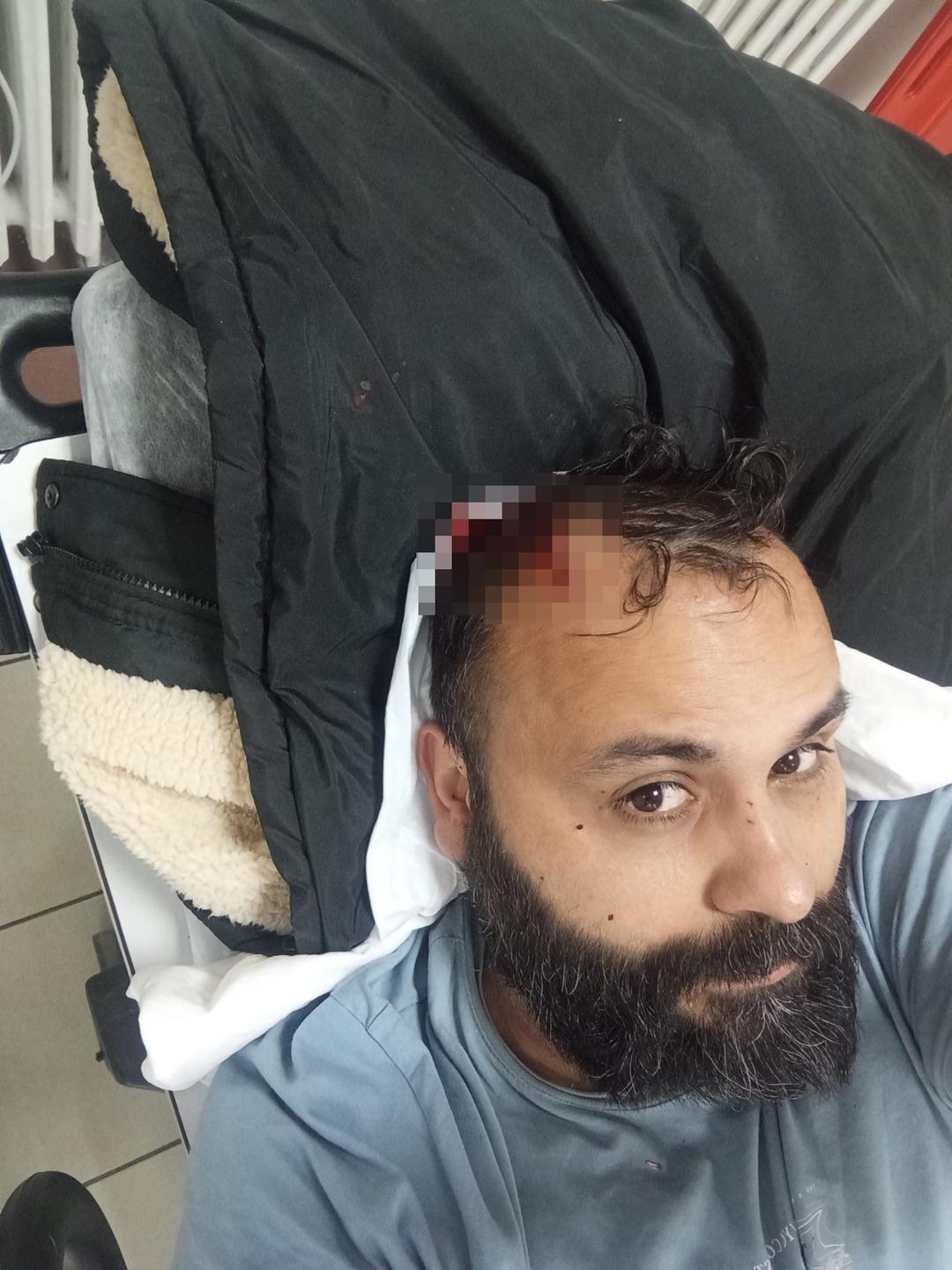 Sosyal medya fenomenini öldüresiye darbettiler! 3.7 milyon takipçisi var: "Kaburgası kırık, iç kanaması var..." 5