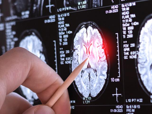 Çok nadir görülen yeni bir hastalık keşfedildi