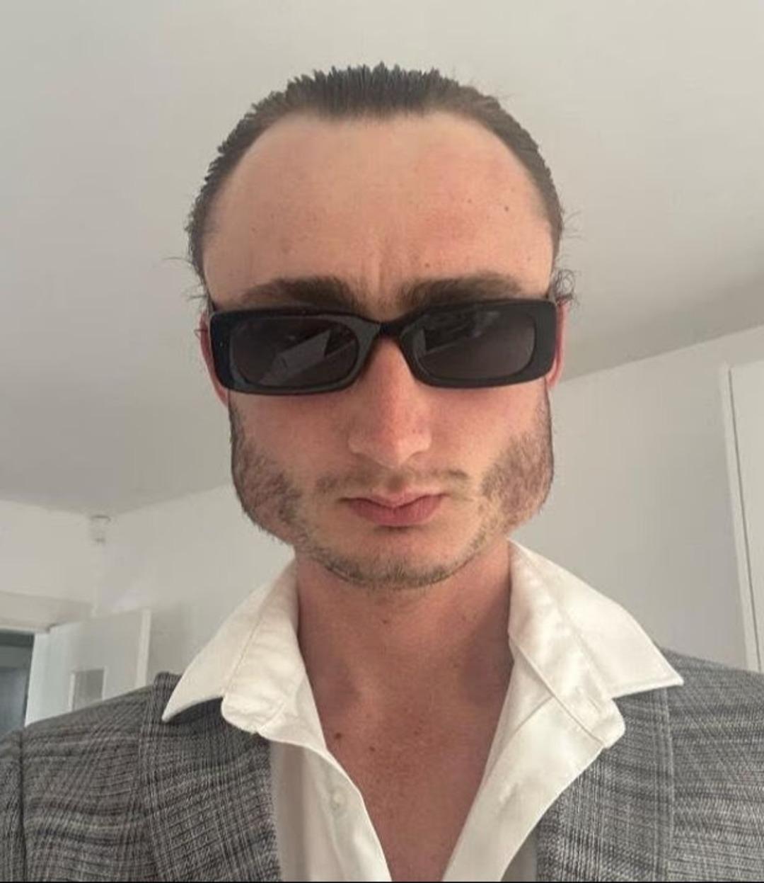 Yaptığı spor yüzünden yüzünün şekli değişti! Eski haline dönmek istiyor... 2