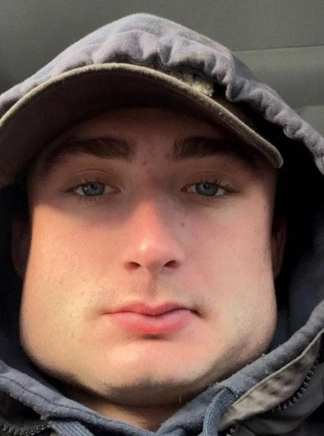 Yaptığı spor yüzünden yüzünün şekli değişti! Eski haline dönmek istiyor... 3