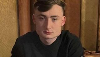 Yaptığı spor yüzünden yüzünün şekli değişti! 