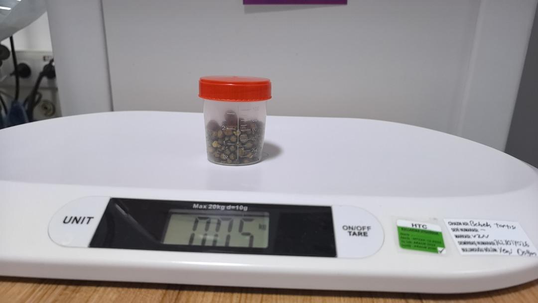 Karın ağrısıyla gitti: Safra kesesinden 213 tane taş &ccedil;ıktı!  3