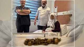 Safra kesesinden çıktı! Görenler inanamadı: 213 tane...