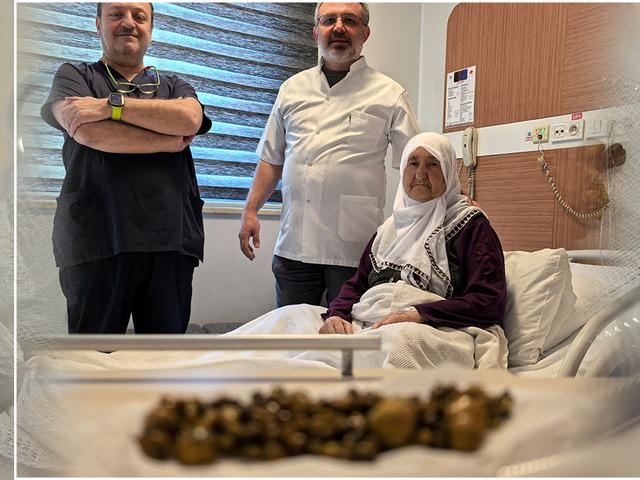 Karın ağrısıyla gitti: Safra kesesinden 213 tane taş çıktı! 