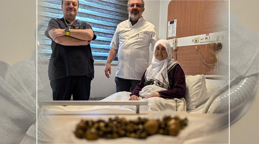 Karın ağrısıyla gitti: Safra kesesinden 213 tane taş &ccedil;ıktı! 