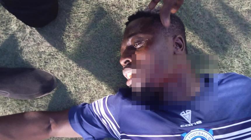 Nijerya Ligi'nde dehşet verici olay! Gol attığı için rakip taraftar sahaya girip boğazını kesti...