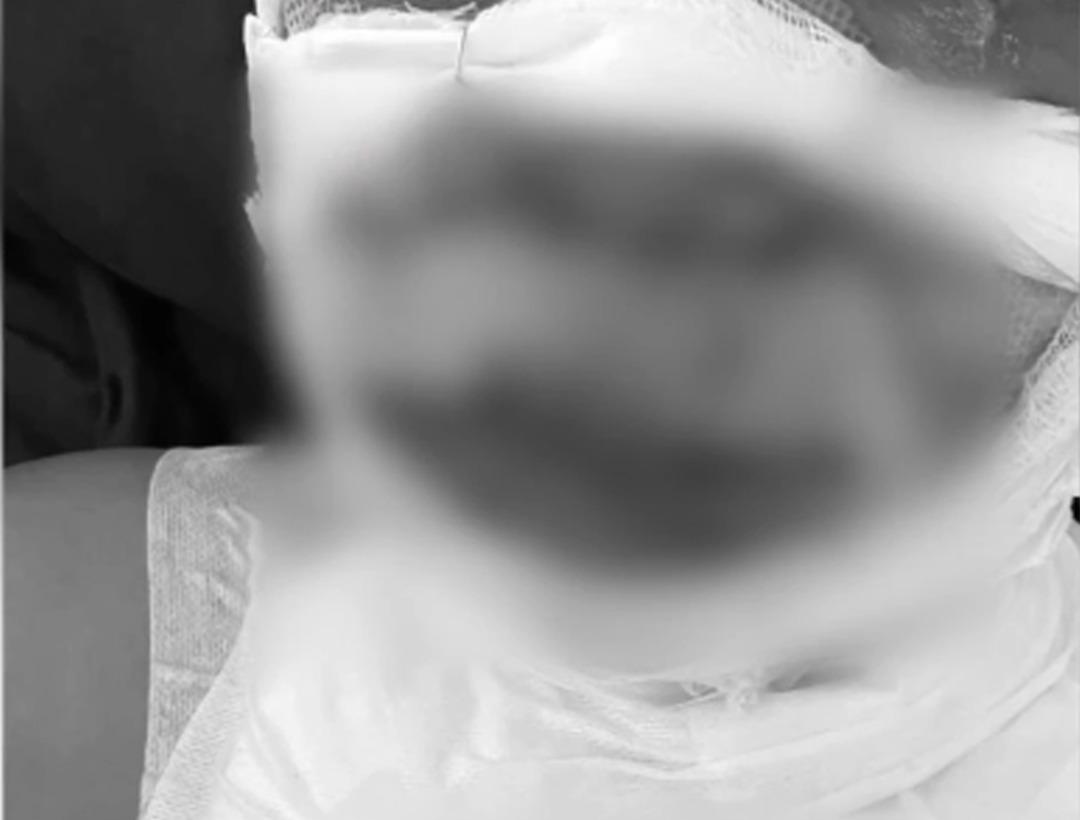 Kadık&ouml;y de vahşet! Kadına yanıcı madde d&ouml;k&uuml;p ateşe verdi: "Sen benim sevgilimle mi birliktesin?" 3