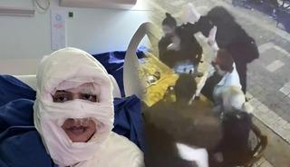 Yer: Kadıköy... Genç kadını ateşe verdi: O anlar ortaya çıktı! "Tehdit mesajları geliyor"