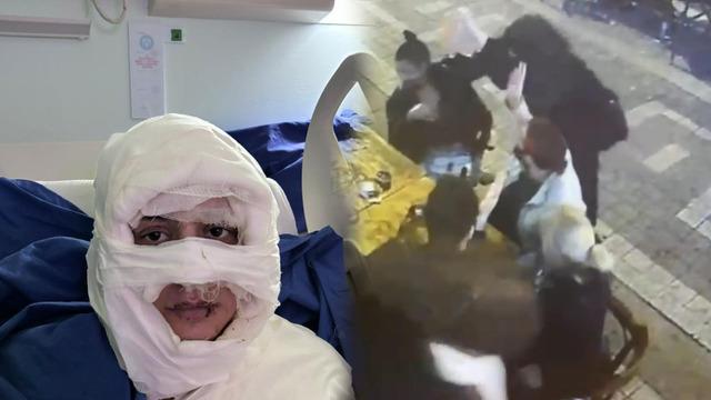 Yer: Kadıköy... Genç kadını ateşe verdi: O anlar ortaya çıktı! "Tehdit mesajları geliyor" | Son Dakika