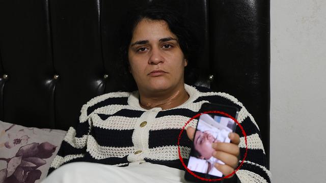 Eşi boğazını kesti engelli kaldı: 2 çocuk annesi dehşet anlarını ilk kez anlattı! Ölme numarası yaptım