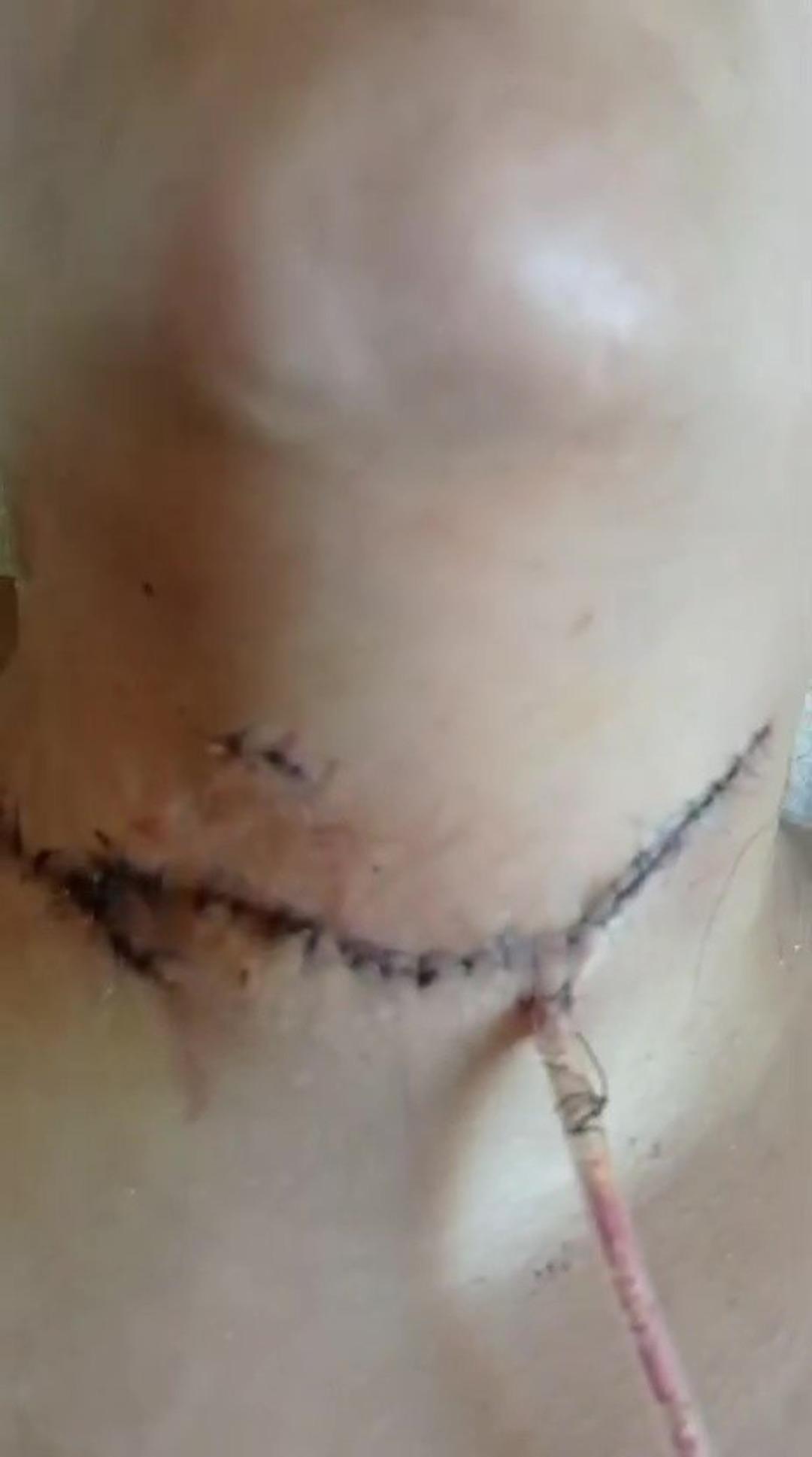 Eşi boğazını kesti engelli kaldı: 2 çocuk annesi dehşet anlarını ilk kez anlattı! "Ölme numarası yaptım" 4