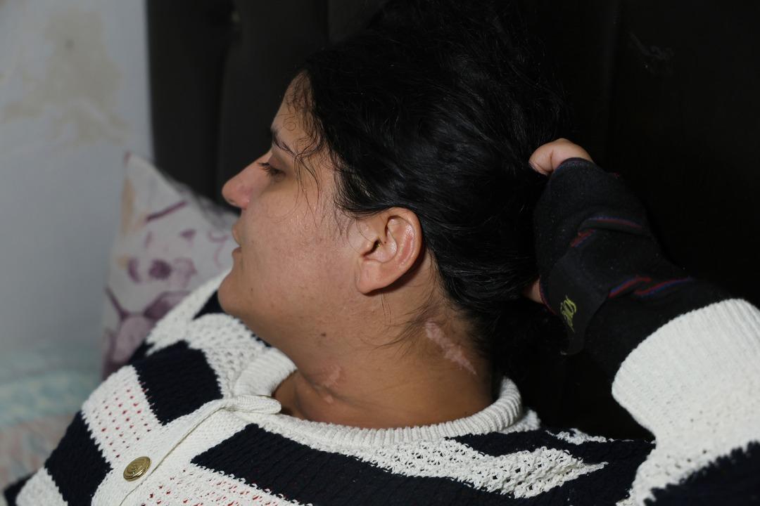 Eşi boğazını kesti engelli kaldı: 2 çocuk annesi dehşet anlarını ilk kez anlattı! "Ölme numarası yaptım" 1