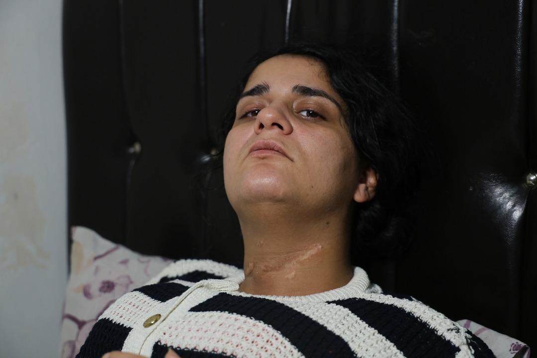 Eşi boğazını kesti engelli kaldı: 2 çocuk annesi dehşet anlarını ilk kez anlattı! "Ölme numarası yaptım" 6