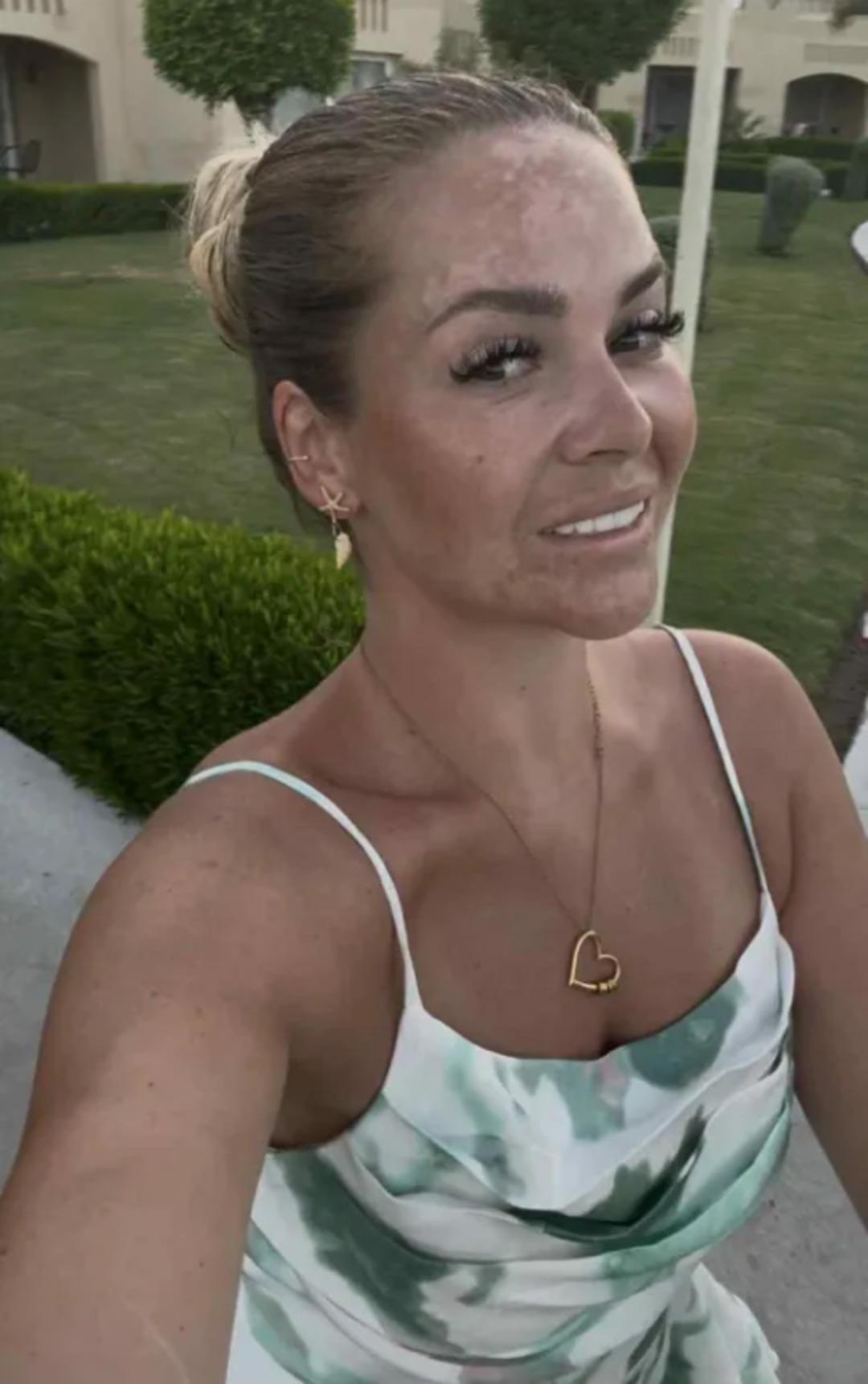 Tek bir şeyden uzak durup 20 kilo verdi! 2 çocuk annesinden itiraf "Hayatımı değiştirdi” 2