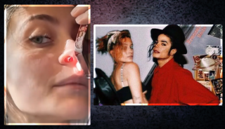 Ünlü isim itirafıyla gündemde! Burnunda açılan deliği gösterip...