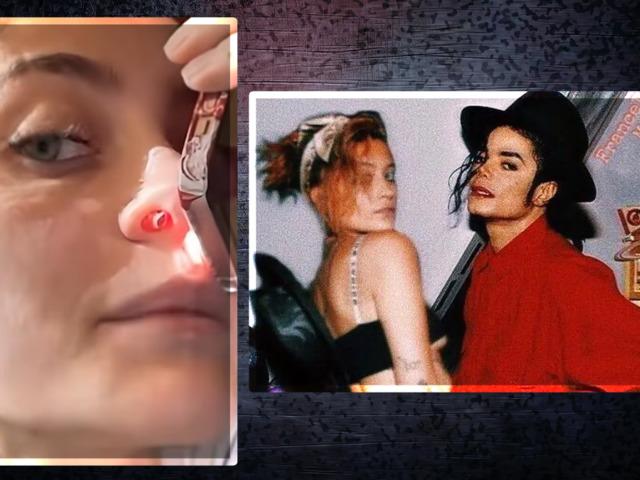 Ünlü isim itirafıyla gündemde! Burnunda açılan deliği gösterip...