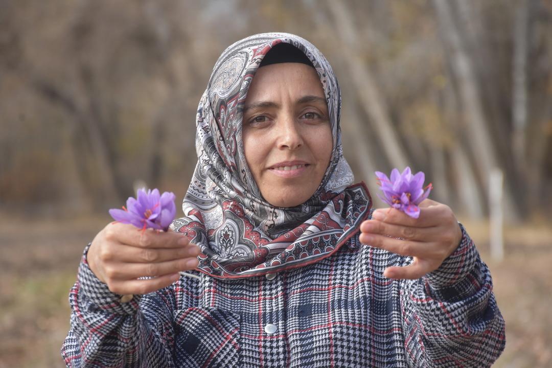Eşini kaybettiği beyin tümörü sürecinde bulamadı: Artık kendi safran üretiyor... 7