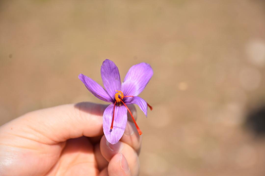 Eşini kaybettiği beyin tümörü sürecinde bulamadı: Artık kendi safran üretiyor... 4