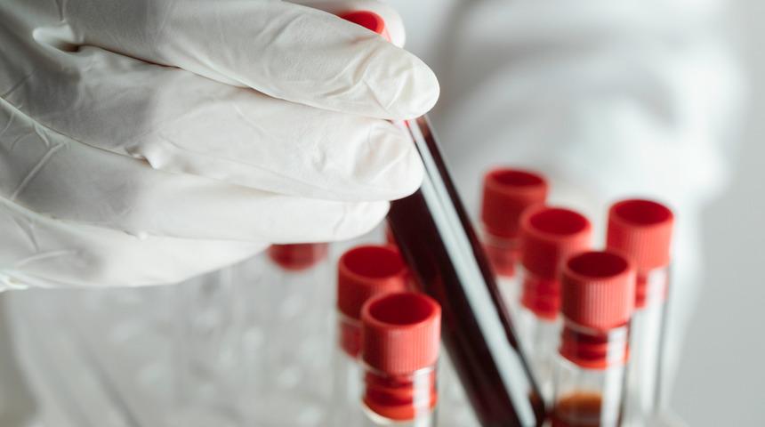 D&uuml;nyada sadece 50 kişide var! 'Altın kan'ın sırrı &ccedil;&ouml;z&uuml;l&uuml;yor: Bir damlası bile servet değerinde!