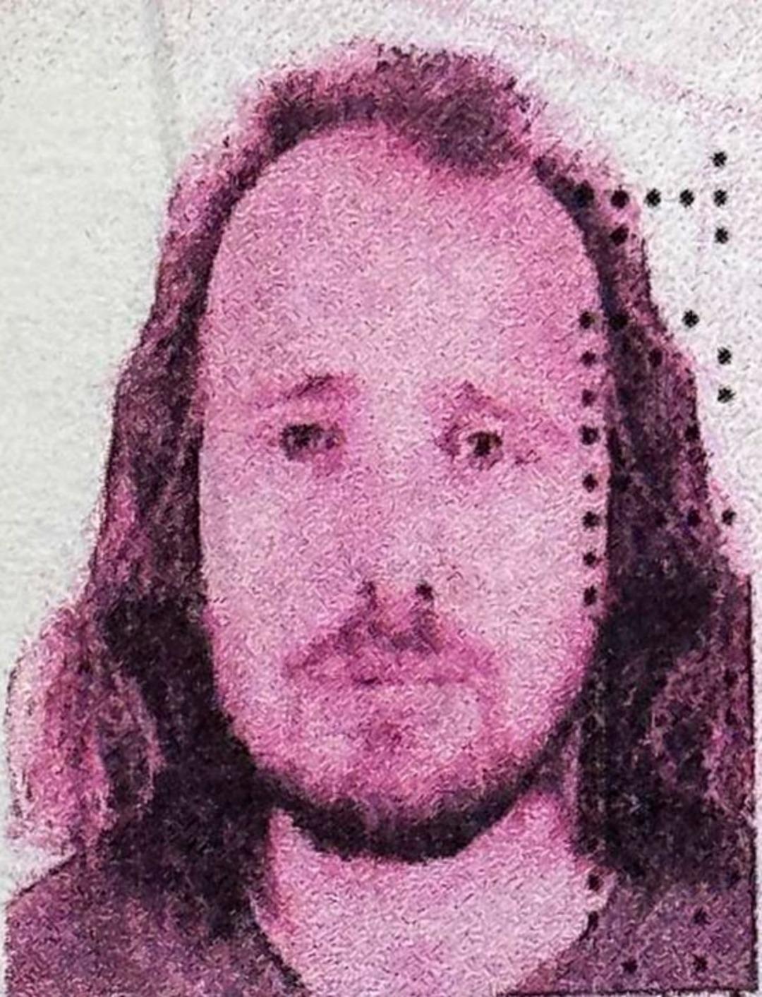 T&uuml;rkiye ye geldi: Amacı sa&ccedil; ektirip diş tedavisi olmaktı! İngiliz turist hayatını kaybetti.... 1