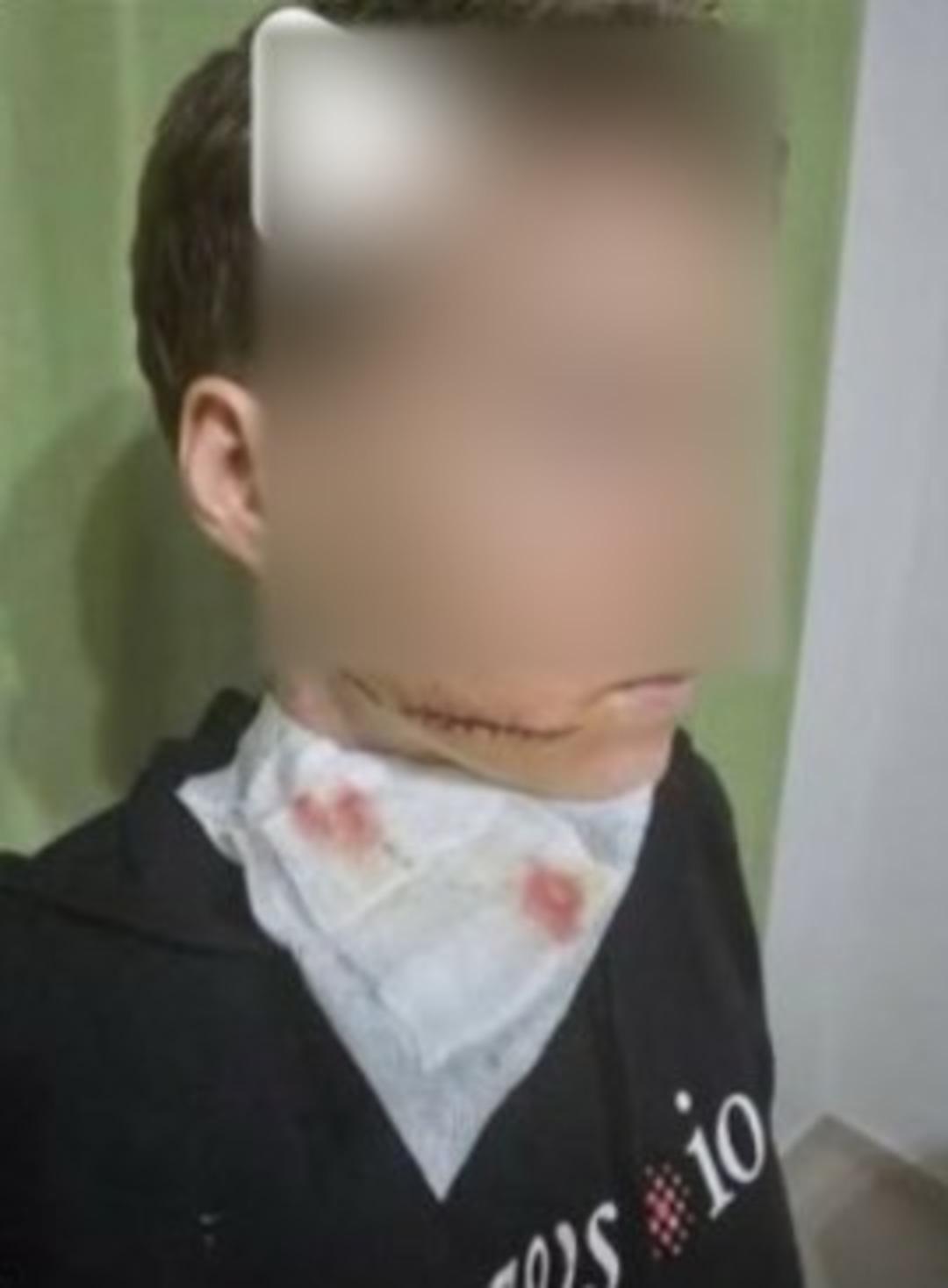 Hiçbir sebep yokken önce yumruk attı ardından yüzünü kesti... Talihsiz kadının son hali ortaya çıktı! 1