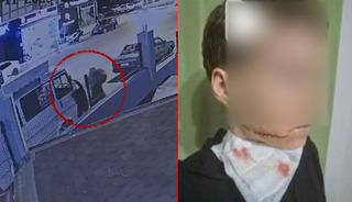 Yolda yürüyen kadına saldırıp yüzünü kesti!