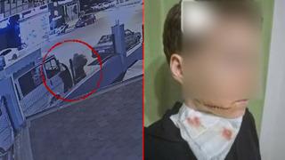 Alanya’da sokak ortasında dehşet! Yolda yürüyen kadına saldırıp yüzünü kesti