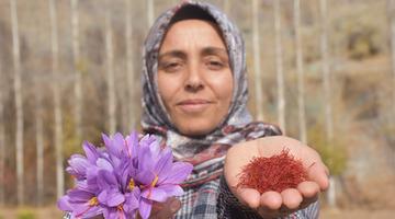 Eşini kaybettiği beyin tümörü sürecinde bulamadı: Artık kendi safran üretiyor...