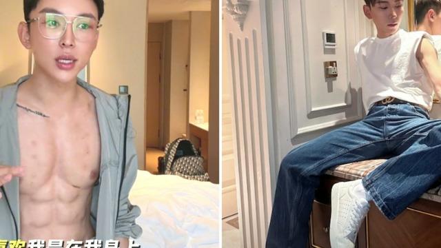 Çin'de ilk oldu! Fenomen isim servet ödeyip yaptırdı! Sağlık sorunu yaşayabilir...