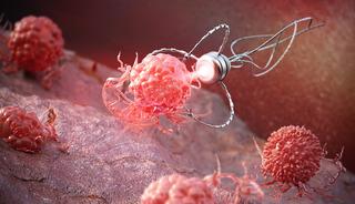 Devrim niteliğinde: 'Mikro robot' dönemi