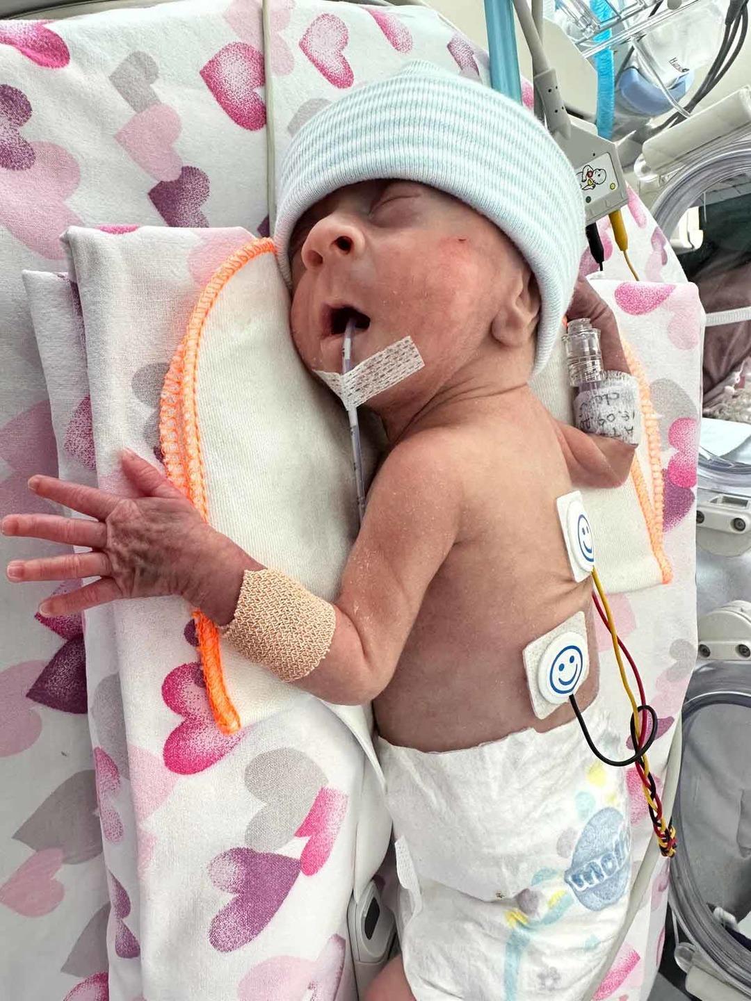 Mucize bebek... 600 gram doğdu: 98 g&uuml;n tedavi g&ouml;ren Asil bebek 2 yaşında 3