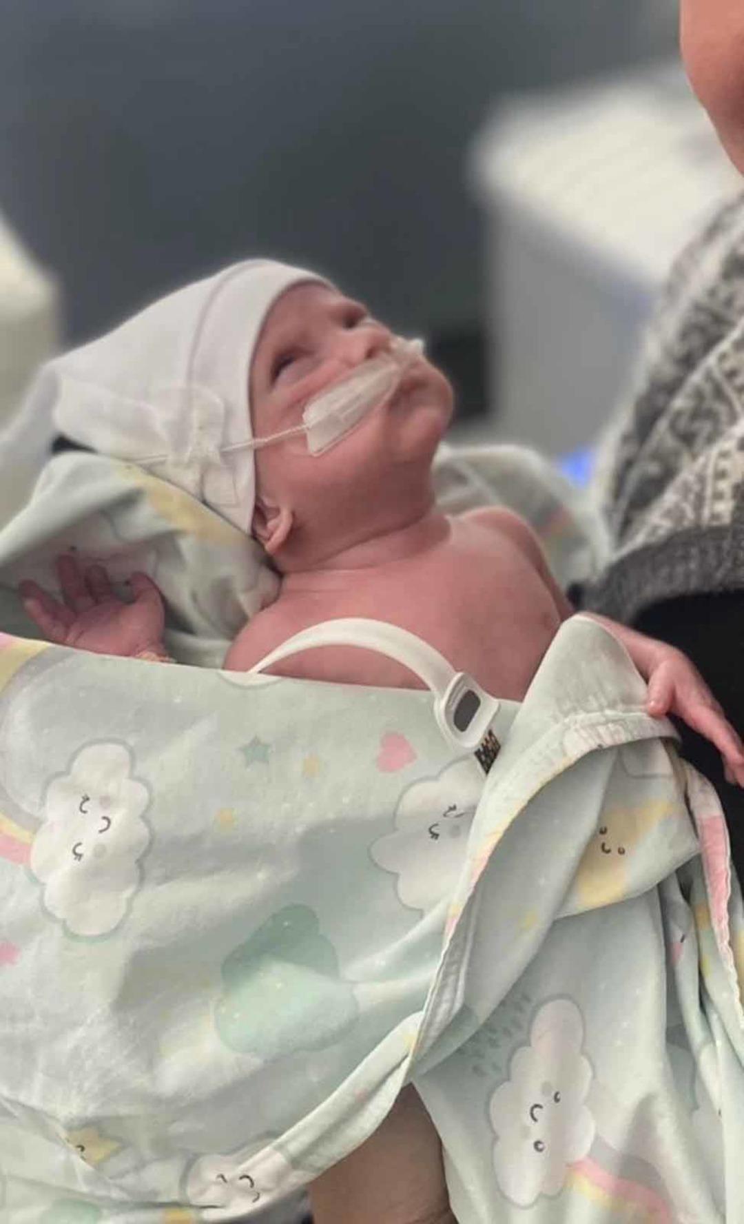 Mucize bebek... 600 gram doğdu: 98 g&uuml;n tedavi g&ouml;ren Asil bebek 2 yaşında 2