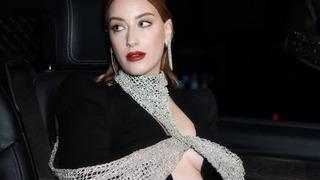 Hazal Kaya'nın yüzündeki değişimler dikkat çekti! Diş estetiği beğenilmedi! 'Eski hali daha iyiydi' 