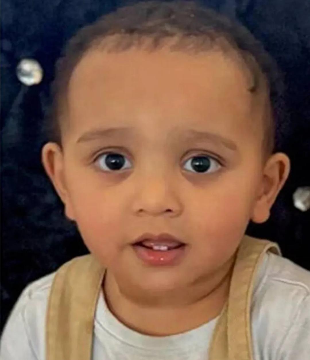 Lavabo açıcı içti, hayatı kabusa döndü! 13 aylık bebek ne yemek yiyebiliyor ne de konuşabiliyor 1