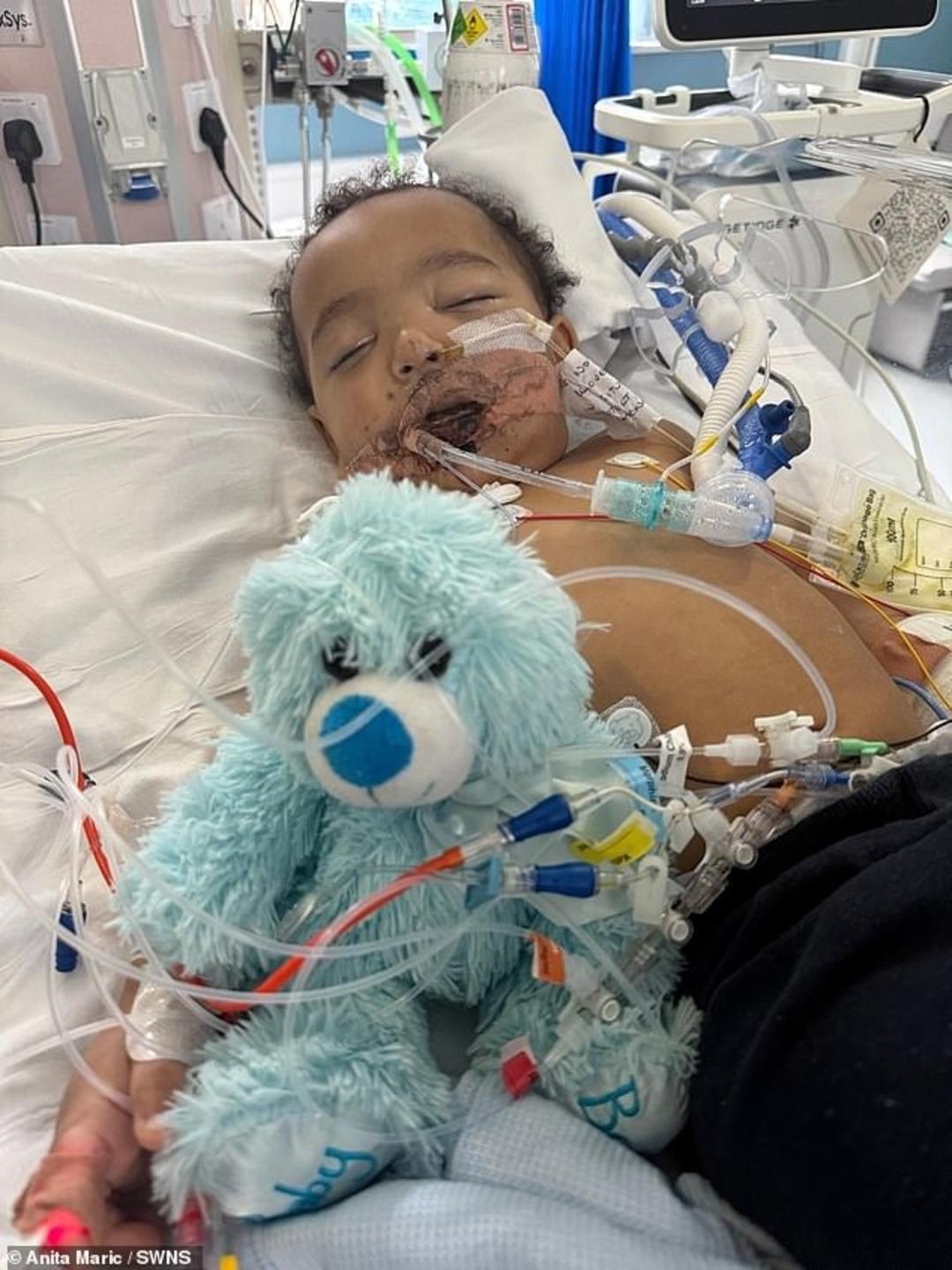 Lavabo açıcı içti, hayatı kabusa döndü! 13 aylık bebek ne yemek yiyebiliyor ne de konuşabiliyor 2