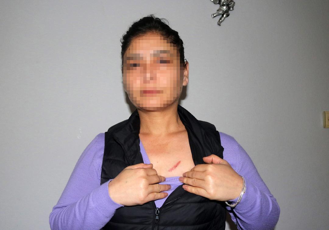 Komşusuna çivili elektrikli saldırıda bulunmuştu: Suçu polise attı! "İnsan hemen ölmez" 1