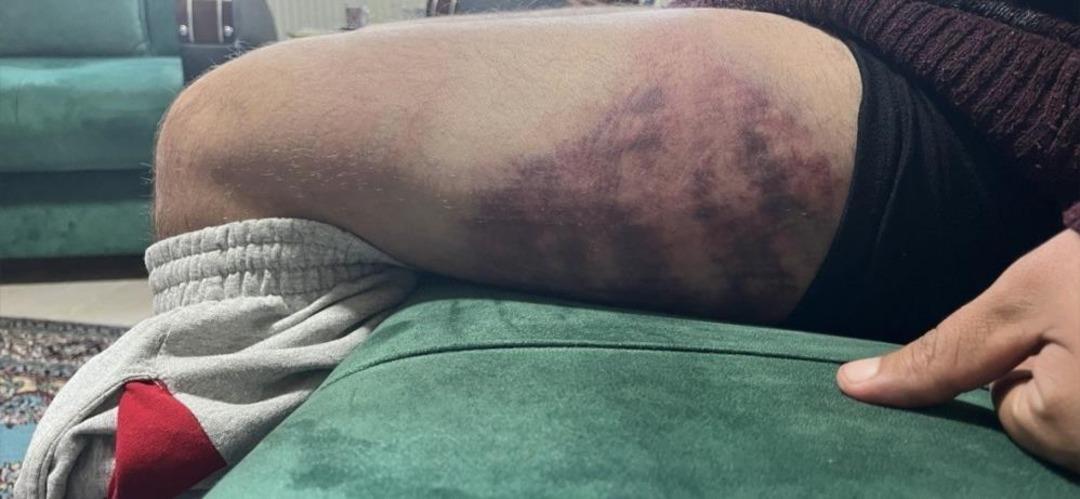 Otizmli genci "odunluğa baktı" diye darbeden fırın çalışanı tutuklandı 1