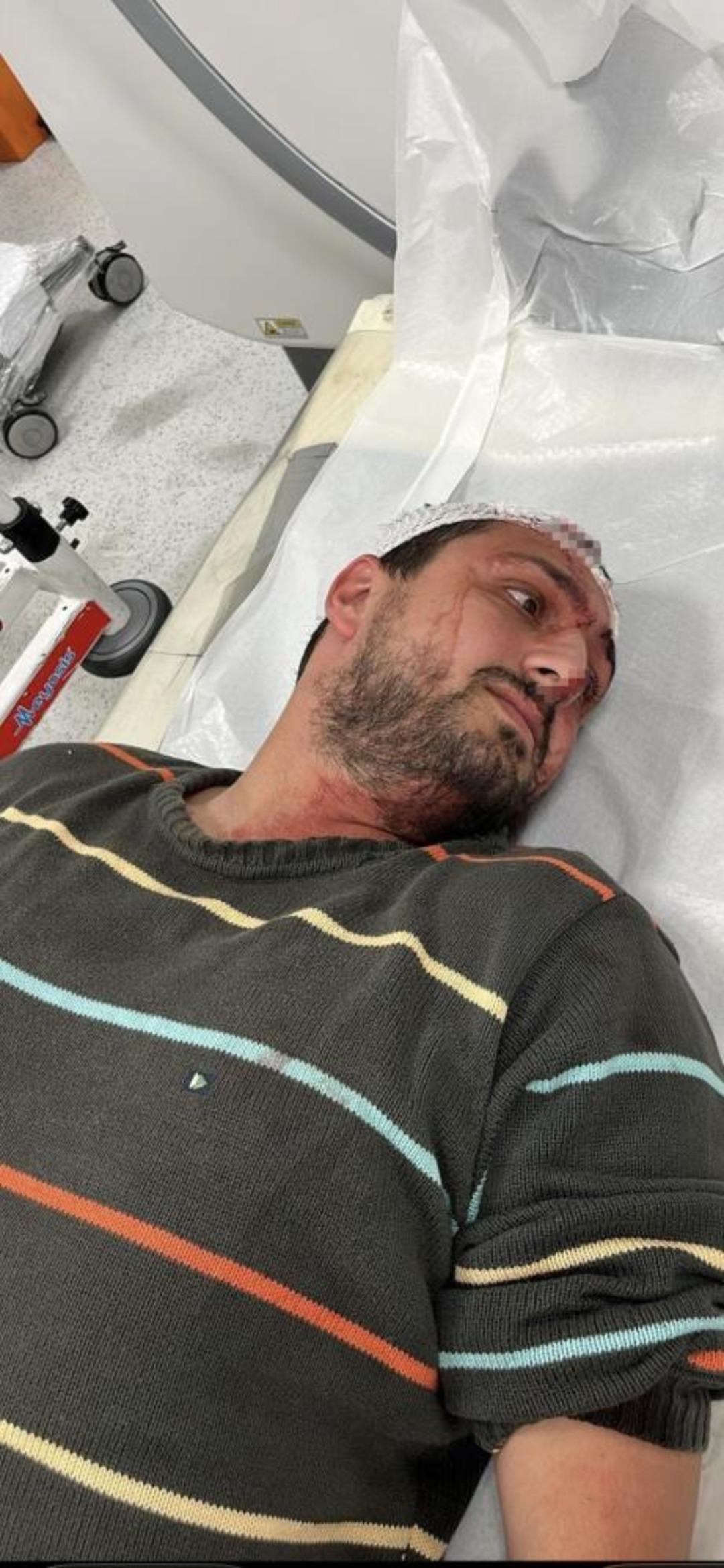 Otizmli genci "odunluğa baktı" diye darbeden fırın çalışanı tutuklandı 2