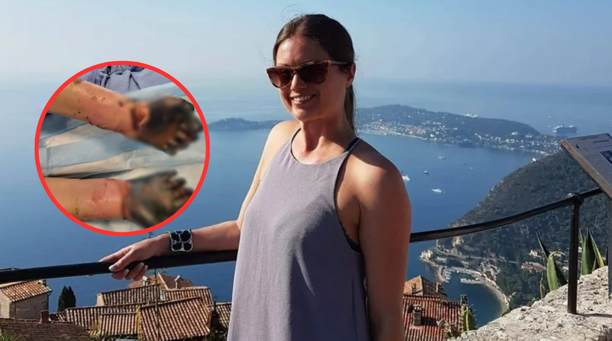 Çenesinde ağrı hissetti, tüm uzuvları ampute edildi! 