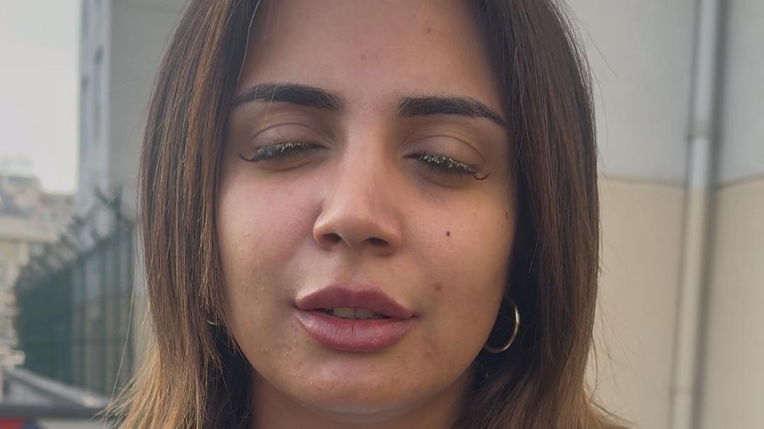 Kirpiklerini yaptırmaya gitti, g&ouml;z&uuml;ne yapıştırıcı ka&ccedil;tı! "K&ouml;r olabilirdim" 1