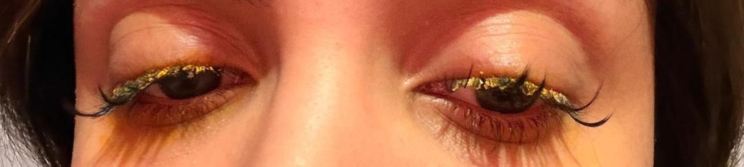 Kirpiklerini yaptırmaya gitti, g&ouml;z&uuml;ne yapıştırıcı ka&ccedil;tı! "K&ouml;r olabilirdim" 2