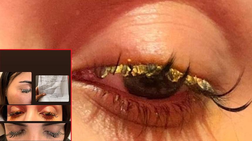 Kirpiklerini yaptırmaya gitti, g&ouml;z&uuml;ne yapıştırıcı ka&ccedil;tı! "K&ouml;r olabilirdim"