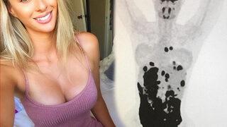 Kanser taramasını böyle paylaştı