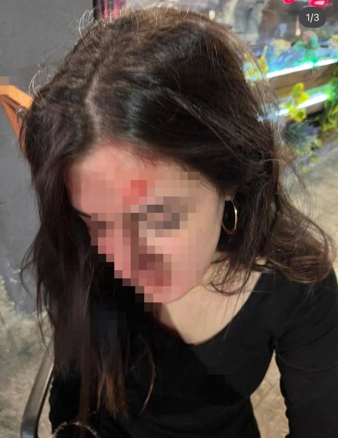 Eski sevgiliye  tuzak   iddiası! Gen&ccedil; kız darbedildiğini s&ouml;yleyip fotoğrafları paylaştı 2