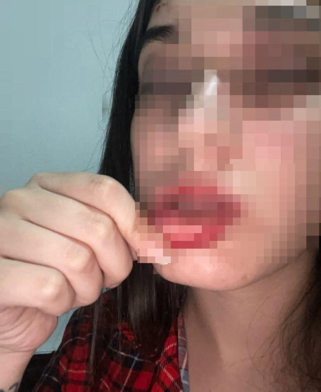 Eski sevgiliye  tuzak   iddiası! Gen&ccedil; kız darbedildiğini s&ouml;yleyip fotoğrafları paylaştı 1