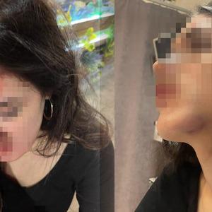 Eski sevgiliye 'tuzak'  iddiası! Genç kız darbedildiğini söyleyip fotoğrafları paylaştı