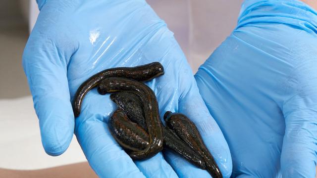 Sülük tedavisi (Hirudoterapi) nedir, faydaları ve riskleri nelerdir? Sülük tedavisi (Hirudoterapi) hakkında merak edilenler 