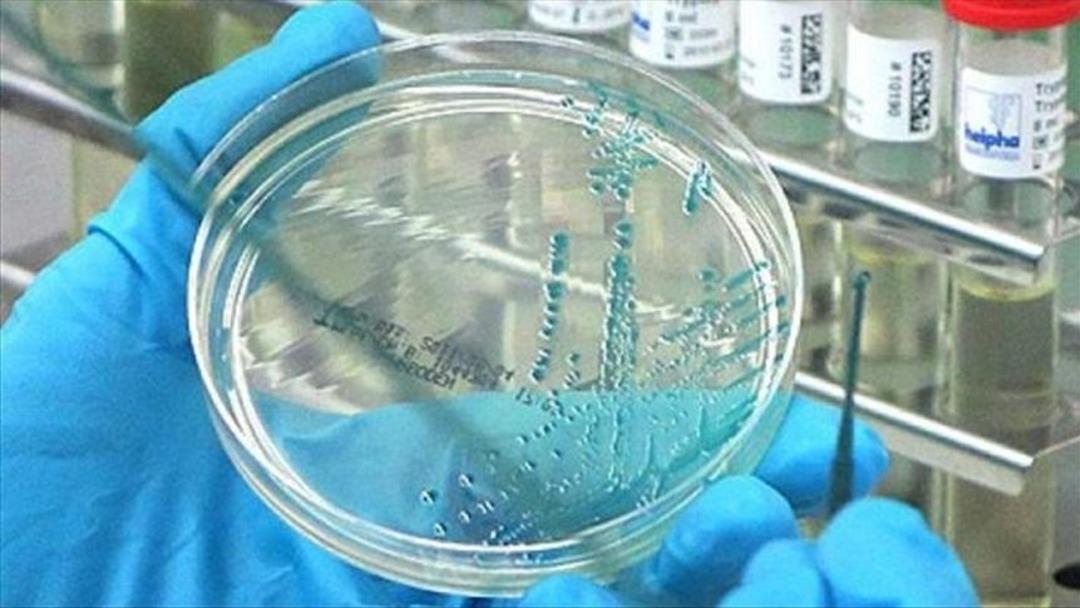 Pandemiden çok daha ağır geçecek  : Covid-19 dan daha büyük bir salgın mı geliyor?  3