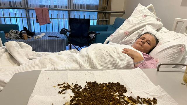 'Taş kadın' gündem oldu! Karın ağrısıyla gitti: 20 bin taş çıkarıldı 