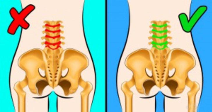   Şiddetli sırt ağrılarından kurtulmak için bu yöntemleri uygulayın